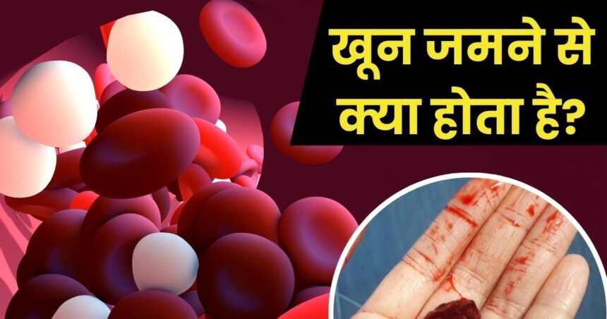 Blood Clotting: What happens when blood clots in the body?  99% people may have this question, know the symptoms and prevention measures here