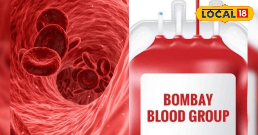 'Bombay Blood Group' is rarely found, listen to what experts said about it