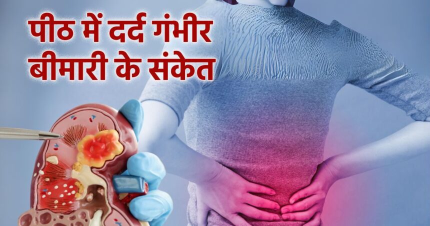 Do not take back pain lightly, it can be a sign of kidney cancer, smokers are at greater risk, know the symptoms.