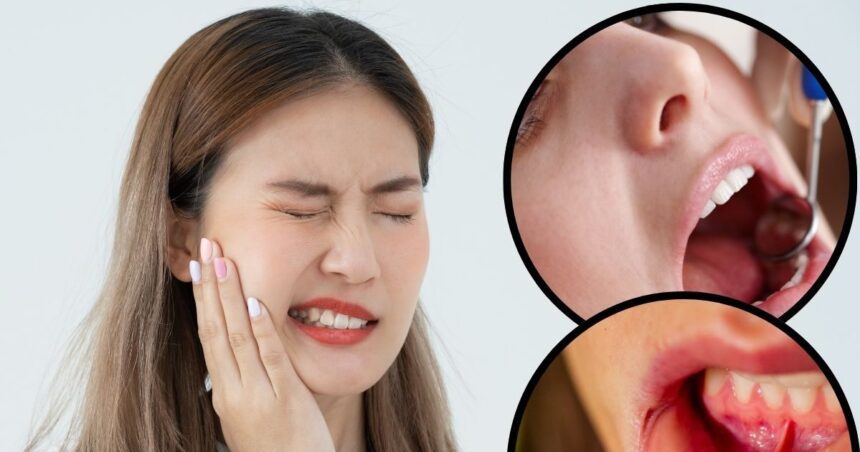If tongue and cheek get cut while eating or speaking, do not worry at all, follow 5 home remedies, oral injury will be cured.