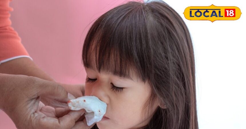 If you adopt this trick in summer, children will remain fit and will not have nose bleeding.