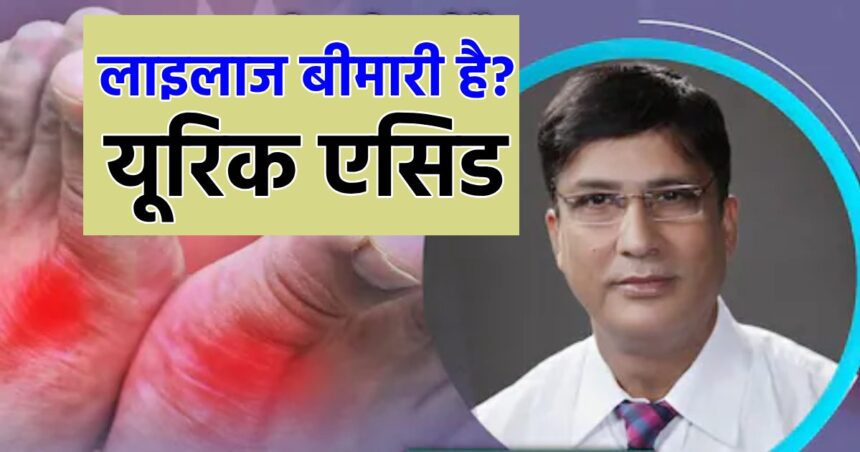 If you become a uric acid patient, will you have to take medicine for the rest of your life?  Know the truth from the doctor