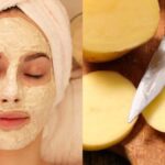 There is a treasure of beauty hidden in potato, dark circles and pigmentation will disappear;  Know how to use it?  - India TV Hindi