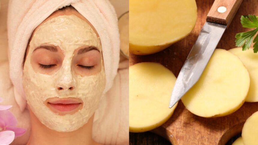 There is a treasure of beauty hidden in potato, dark circles and pigmentation will disappear;  Know how to use it?  - India TV Hindi