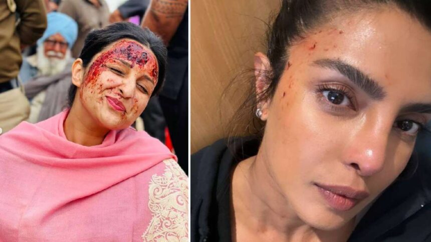 This picture of Parineeti Chopra 'soaked in blood' is going viral - India TV Hindi