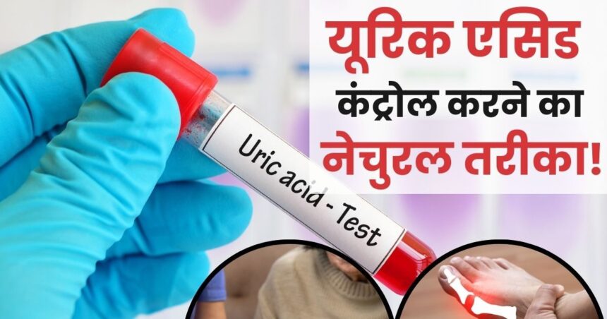 Uric Acid: Uric acid will reduce naturally in 1 week, you just have to do these 4 things, there will be no need for medicine.