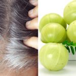 Use Amla on hair in these 3 ways, white hair can become black and thick - India TV Hindi