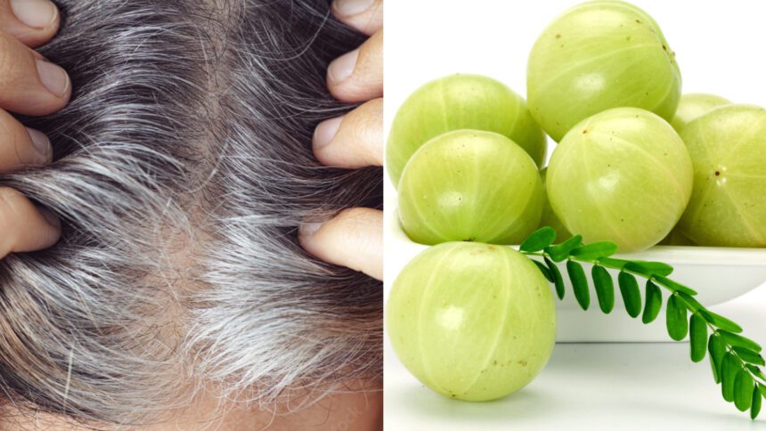 Use Amla on hair in these 3 ways, white hair can become black and thick - India TV Hindi