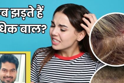 What will happen if more than 100 hairs start falling in a day?  Is it normal or a sign of some disease, know the right thing from the doctor