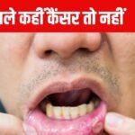 Are ulcers in the mouth a sign of cancer? How to identify it, when does it become a matter of concern, know everything