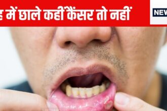 Are ulcers in the mouth a sign of cancer? How to identify it, when does it become a matter of concern, know everything