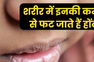 Are your lips cracking in the heat?  Lack of these 4 nutritions in the body can be the reason