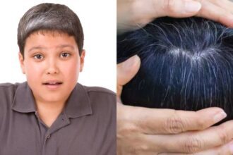 Children's hair has started graying at an early age, know from experts what to do to prevent gray hair? - India TV Hindi