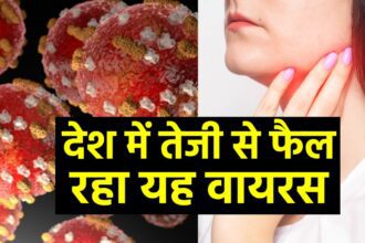 Have you lost your appetite along with headache and fever?  This virus may attack, cases increase in Delhi-NCR