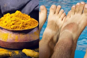 If you are worried about tanning of hands and feet then try this home remedy of turmeric, you will get amazing glow - India TV Hindi