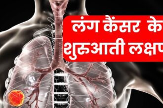 Know whether you have lung cancer by these symptoms?  Early detection can save life