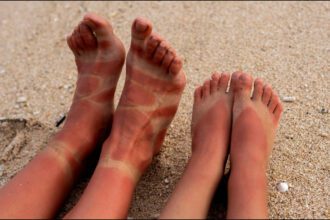 Mix these 2 things in toothpaste and apply it on your feet, tanning and cracked heels will be cleaned - India TV Hindi
