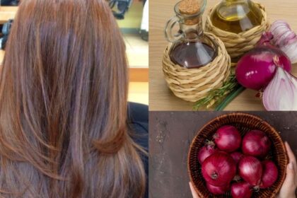 Onion oil will strengthen your hair from the roots and will also get rid of dandruff;  Know how to make and use oil?  - India TV Hindi