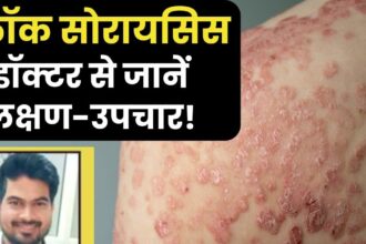 This disease will spoil the skin and beauty of the body, it starts with round spots, then wreaks havoc, know the symptoms and treatment.