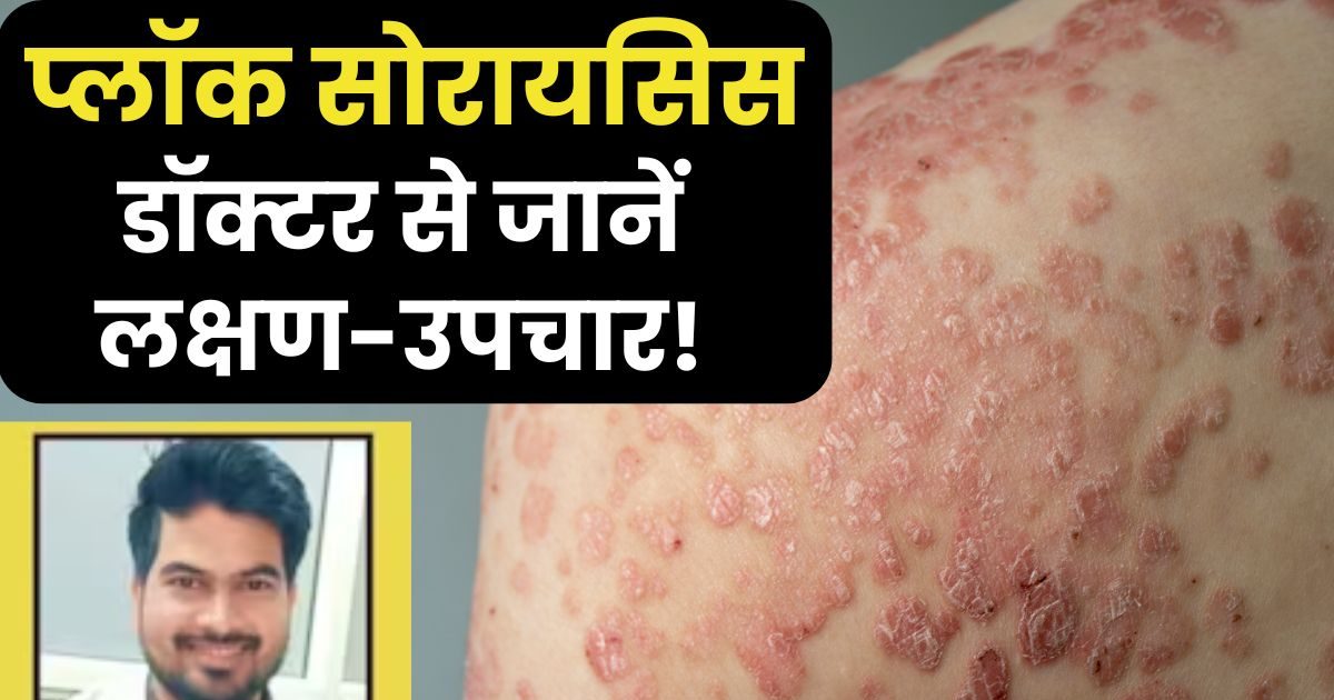 This disease will spoil the skin and beauty of the body, it starts with round spots, then wreaks havoc, know the symptoms and treatment.