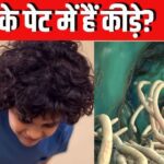 How to understand if your child has worms in his stomach? Identify them with these symptoms, the doctor told the right way to deworm