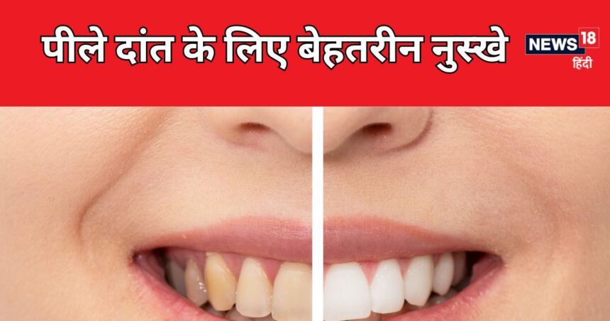 Yellow teeth can be dangerous! You can make them white instantly, just try these things