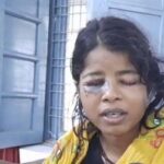 Madhya Pradesh: Accused of putting acid in the girl's eye, the administration started investigation