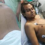 The stomach of the young man was growing continuously for 2 months, the surprising truth came to the fore