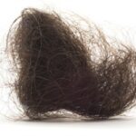 2 kg hair ball came out of stomach of UP girl