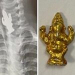 3 year old child swallows Lord Ganesha idol in Karnataka, doctors saved him alive