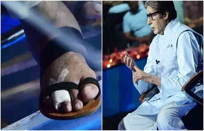 Big B came to shoot with fractured thumb, shared the photo on his blog