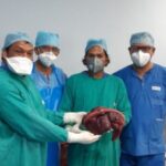 Bihar: 6 kg tumor removed from the girl's stomach, was attached to the intestine