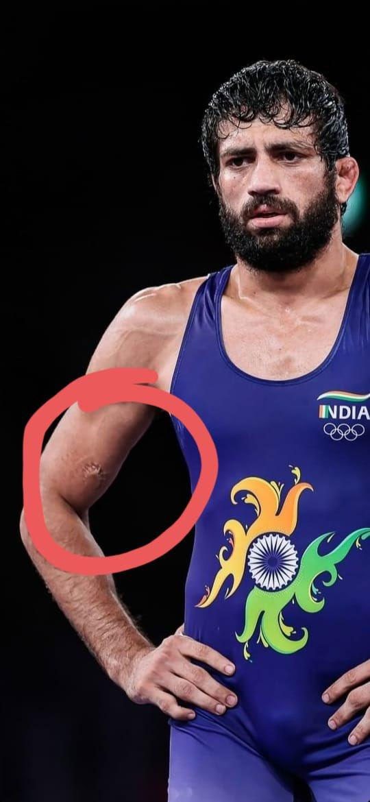 Tokyo Olympics 2020: When the player could not win the match, he did this dirty act, Indian wrestler did not lose his spirits