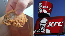 If you are also a customer of KFC then be careful, the disturbing thing that came out of this lady customer's dish