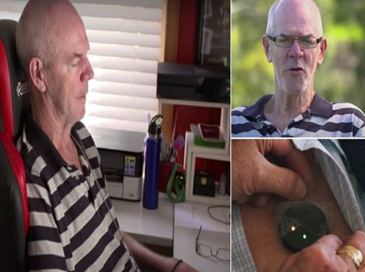 Now tweeting can be done just by thinking, 62-year-old Philip, living in Australia, did a unique feat