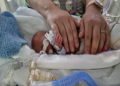Wonderful: This miraculous child was born in just four months, still alive