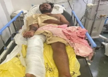 Karnataka: Acid attacker arrested, police shot him in leg while escaping - Bengaluru News in Hindi