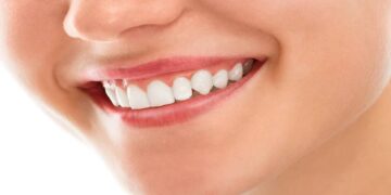Teeth Care: If you are troubled by yellowing of teeth, then leave these 7 things today