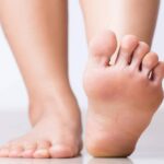 feet swollen,increased uric acid,uric acid, uric acid control tips