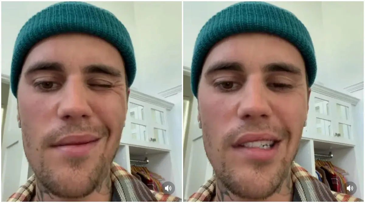 Justin Bieber reveals partial face paralysis: 'It will go back to normal'