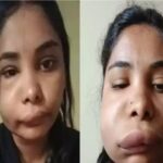 Kannada Actress Swati Satish had to undergo surgery, her face was ruined.. it is difficult to even recognize.