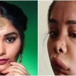The face of kannad actress swathi satish deteriorated after surgery