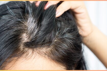 Increase this 1 thing in the body and the problem of white hair will not happen again, know what to do?  - India TV Hindi