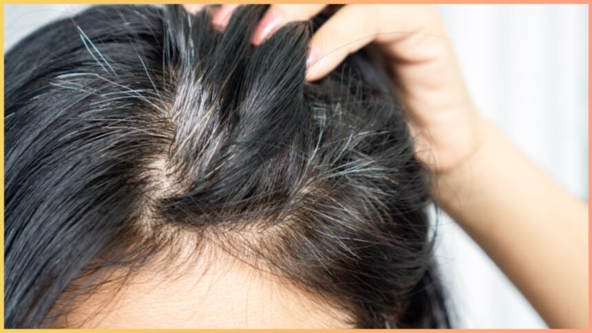 Increase this 1 thing in the body and the problem of white hair will not happen again, know what to do?  - India TV Hindi