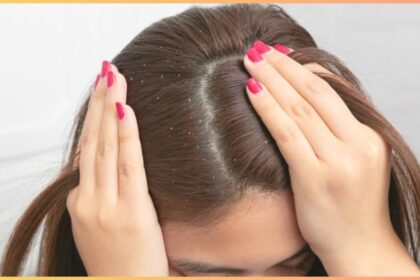 Got rid of dandruff!  Try these home remedies suggested by experts yourself - India TV Hindi