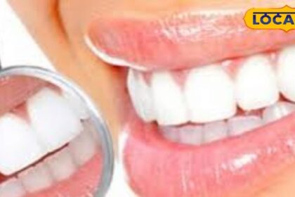 Teeth not cleaned even with toothpaste?  So try this home remedy, then people will ask you the secret of your glow.