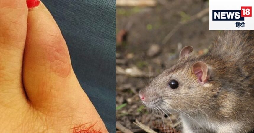 Can rabies be caused by rat or mole bite?  Should the vaccine be administered?  Know what the Health Ministry guidelines say
