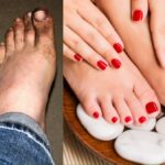 Do pedicure at home like this with shampoo worth Rs 2, black and ugly feet will get amazing glow in 15 minutes - India TV Hindi