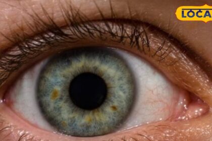 Glaucoma affects not only the eyes but also the brain, know the causes and preventive measures from the doctor.