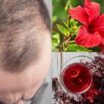 Hair falling at double the speed?  Hair grows even on bald heads with this flower;  Know how to use it?  - India TV Hindi